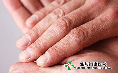 牛皮癬中醫病理是什么?初期癥狀表現?